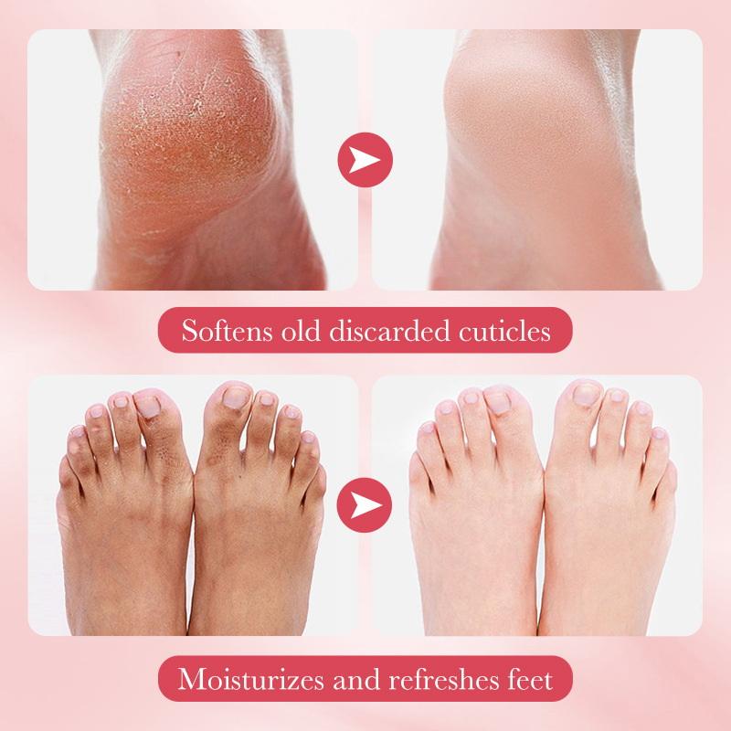 Skincare Exfoliating - 1 Pairs SADOER Fruits Foot Mask