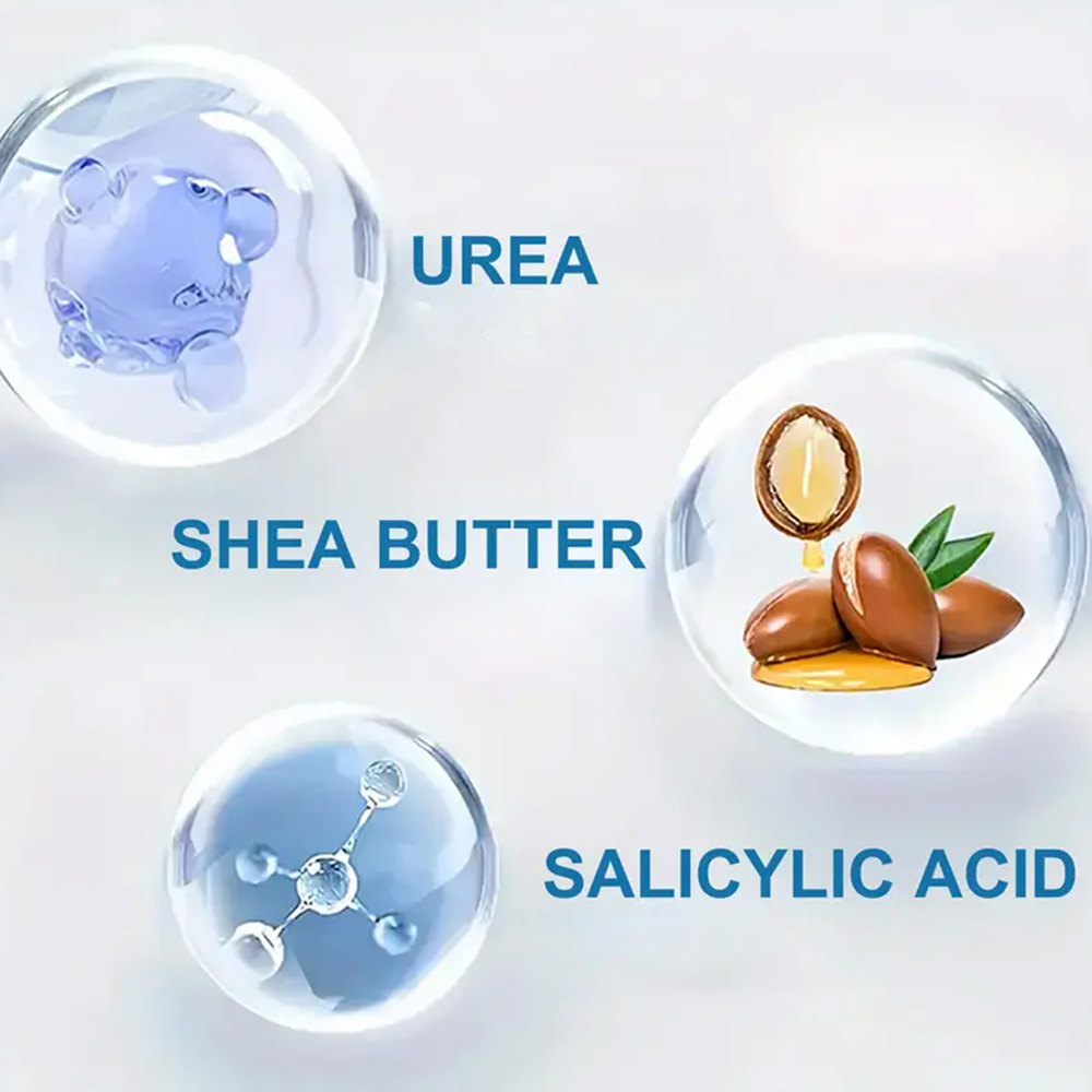 YOUNGCOME 250G Urea Cream with - Azelaic Acid Cream ulasan dan harga