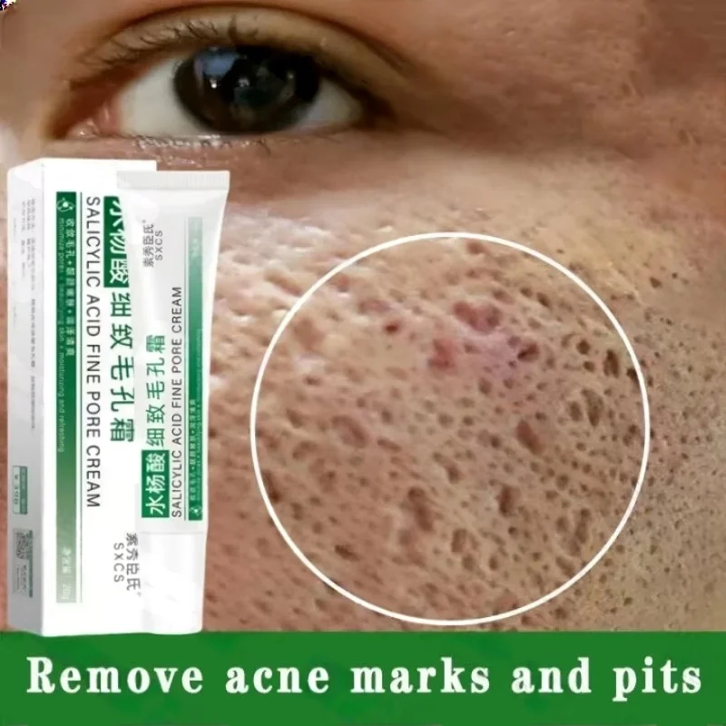 Salicylic Acid Pore Clearing C - Azelaic Acid Cream ulasan dan harga