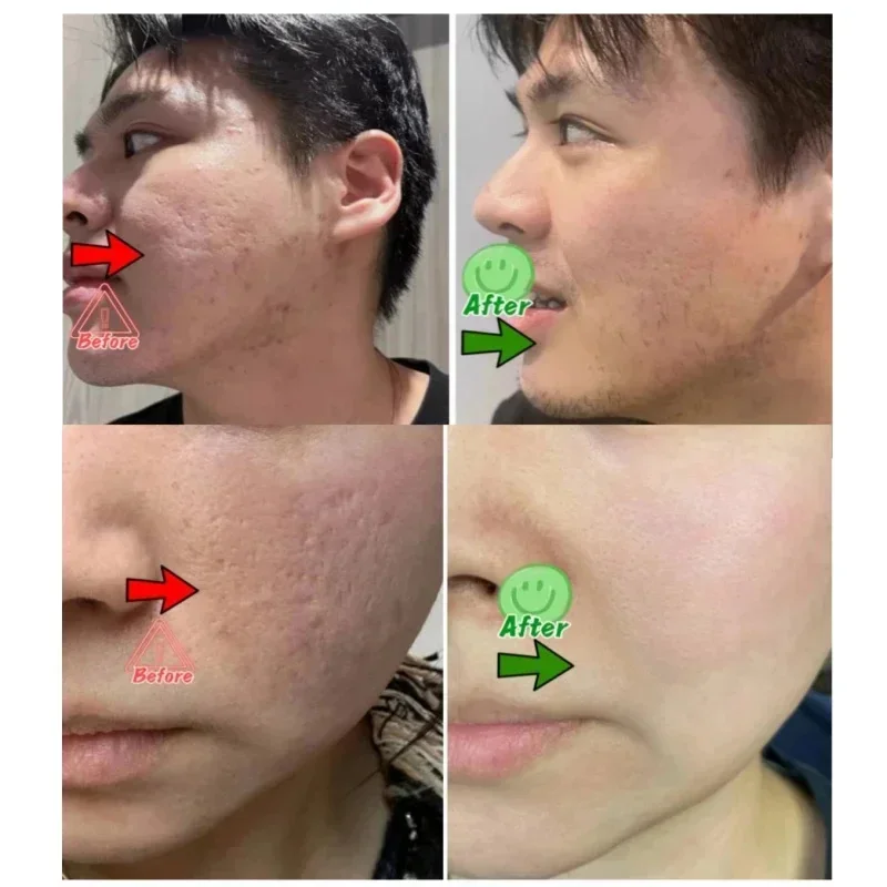 Salicylic Acid Pore Clearing C - Azelaic Acid Cream ulasan dan harga