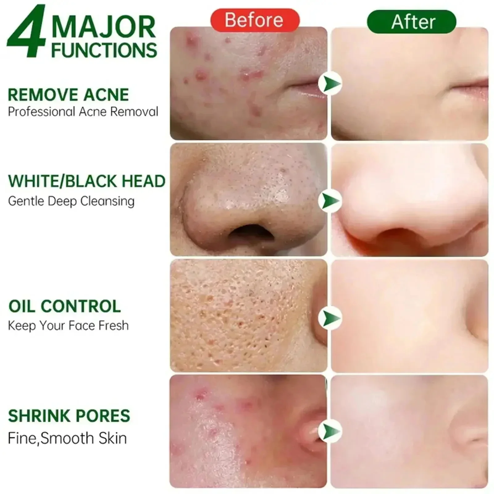 Salicylic Acid Pore Clearing C - Azelaic Acid Cream ulasan dan harga