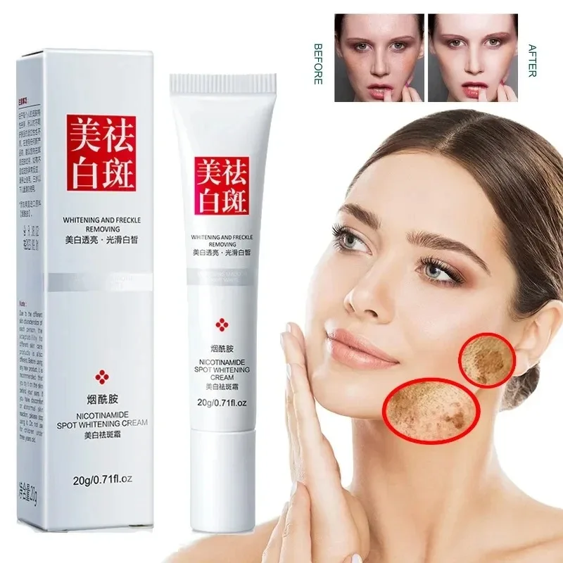 Fades Freckle Dark Spots Face  - Skincare Niacinamide ulasan dan harga