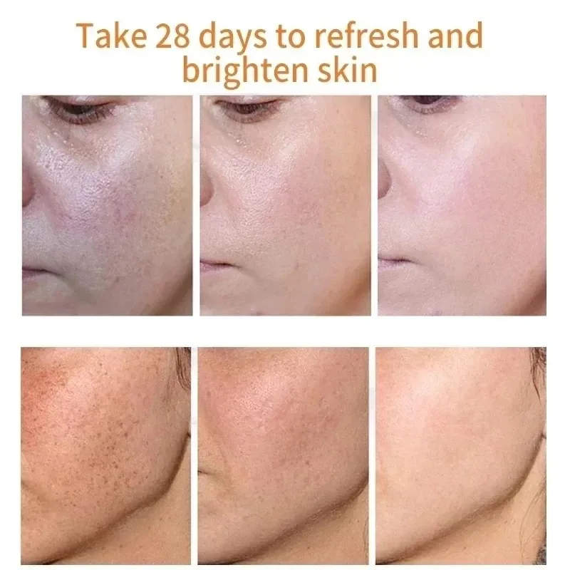 Fades Freckle Dark Spots Face  - Skincare Niacinamide ulasan dan harga