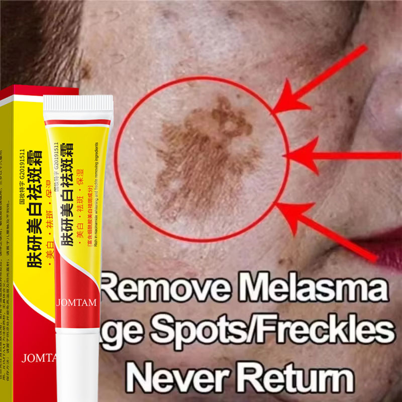 Whitening Freckle Cream Face B - Skincare Niacinamide ulasan dan harga