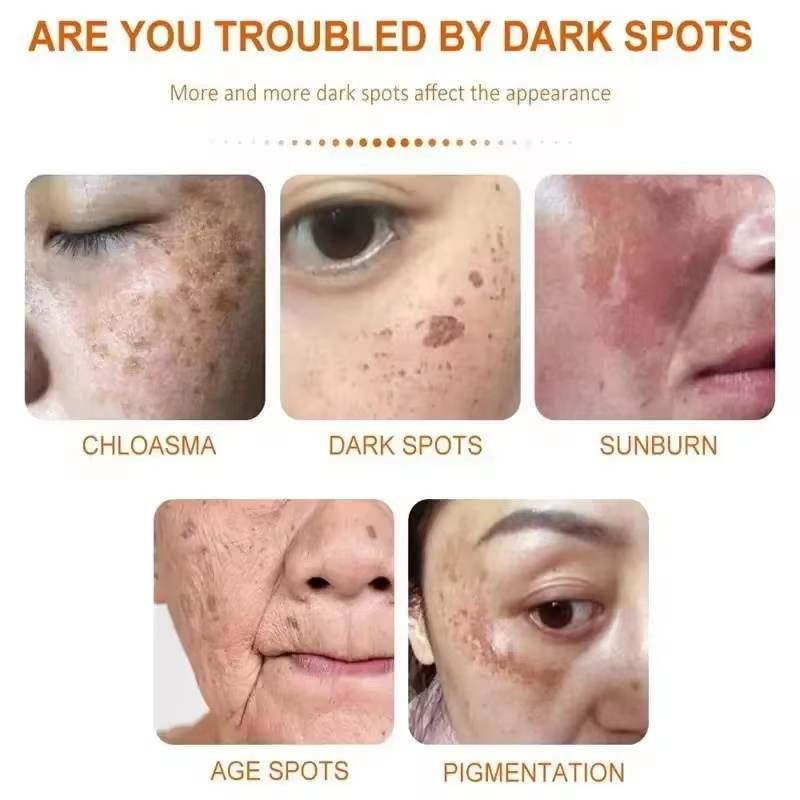 Whitening Freckle Cream Face B - Skincare Niacinamide ulasan dan harga