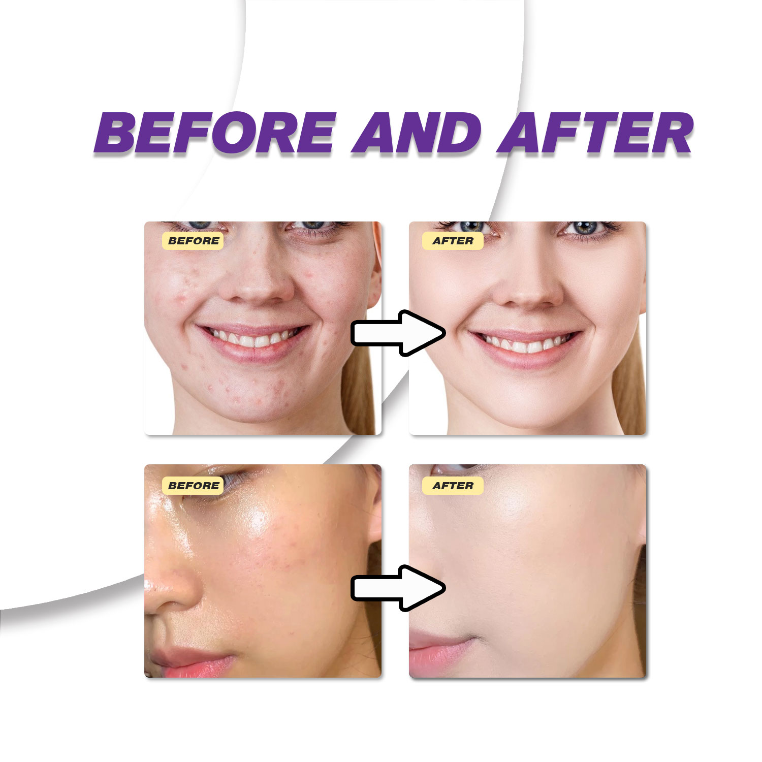Mild Azelaic Acid Cream Improv - Azelaic Acid Cream ulasan dan harga